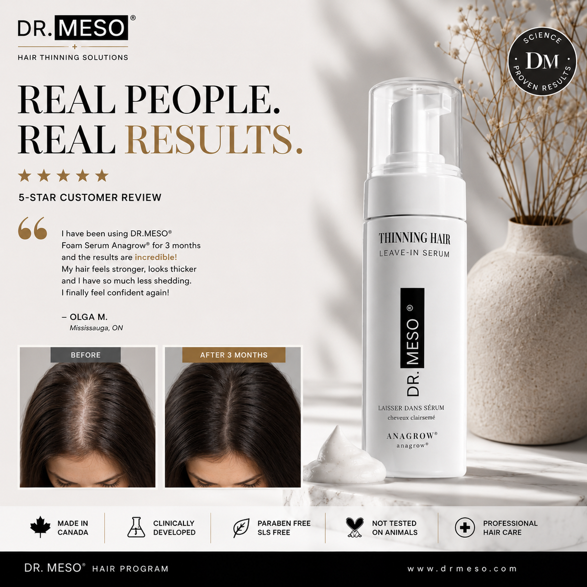 Hair thinning and sensitive scalp care routine | DR.MESO® Canada