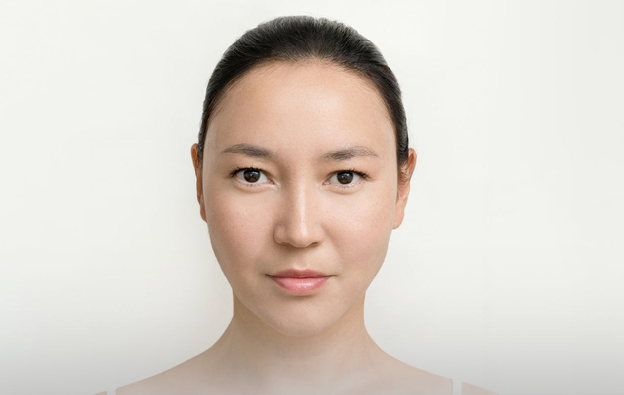 After Pure Peel treatment – smoother brighter skin
