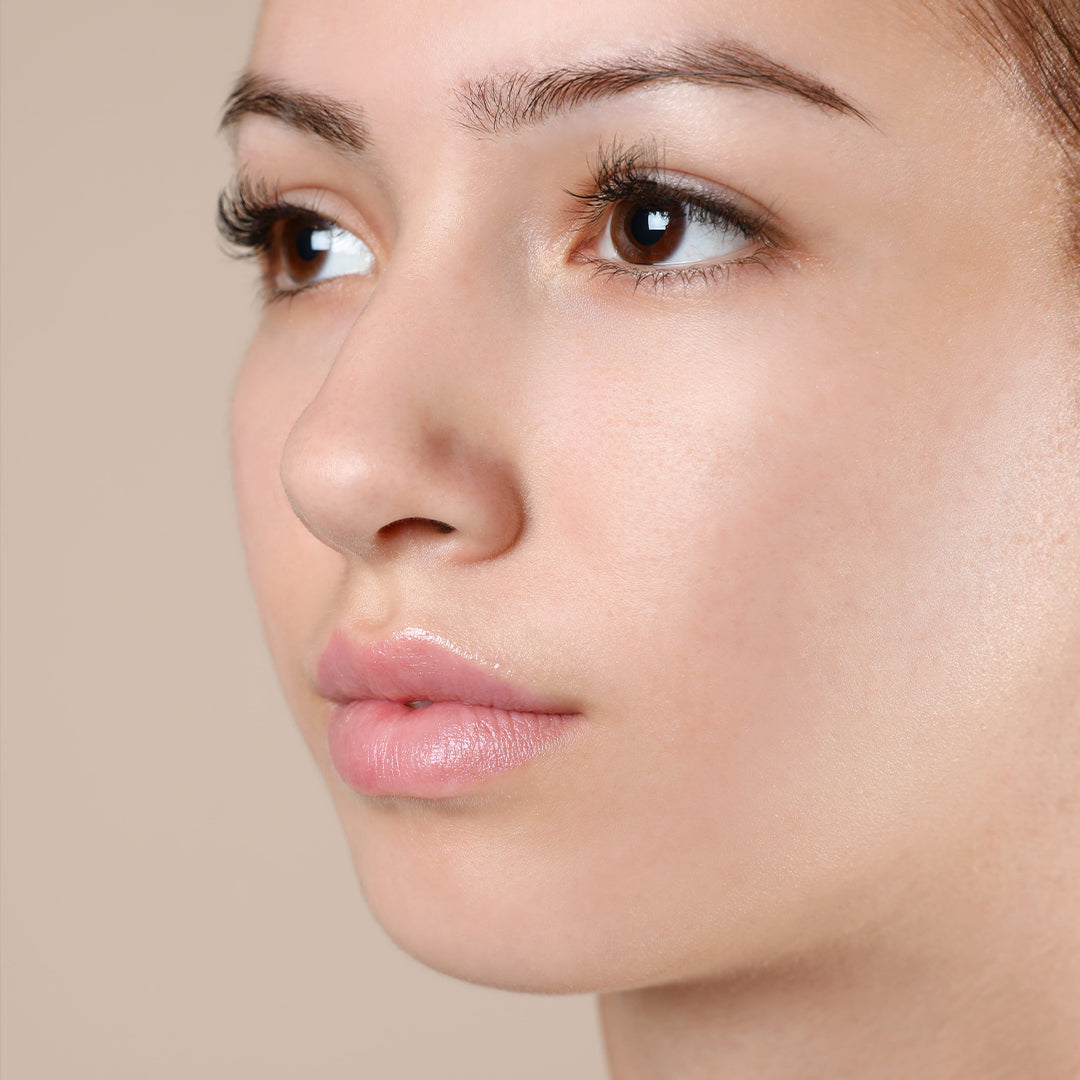 Pure Peel treatment after image – improved clear skin
