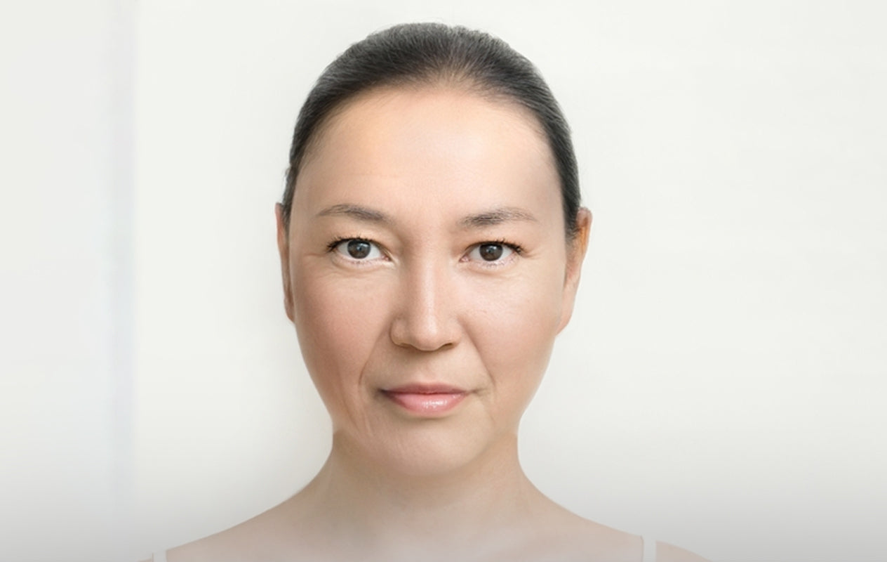 Before Pure Peel treatment – visible skin concerns
