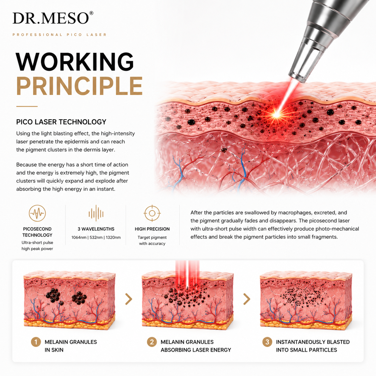 CARBON LASER