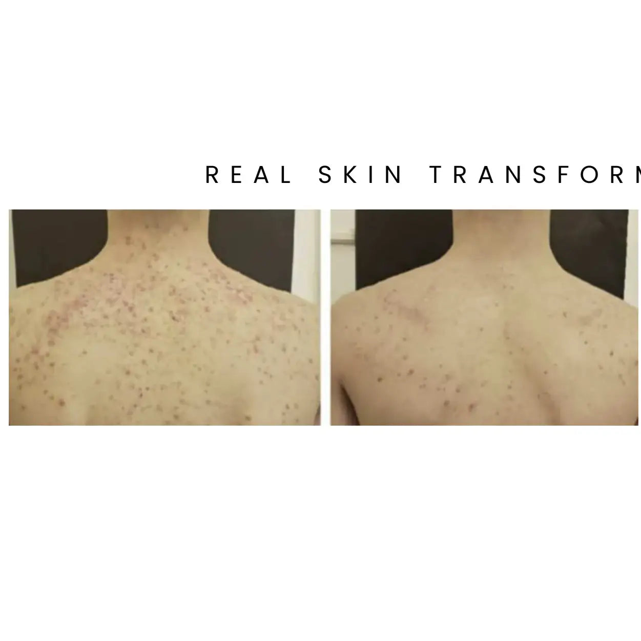 TRIPLE ACTION BODY WASH