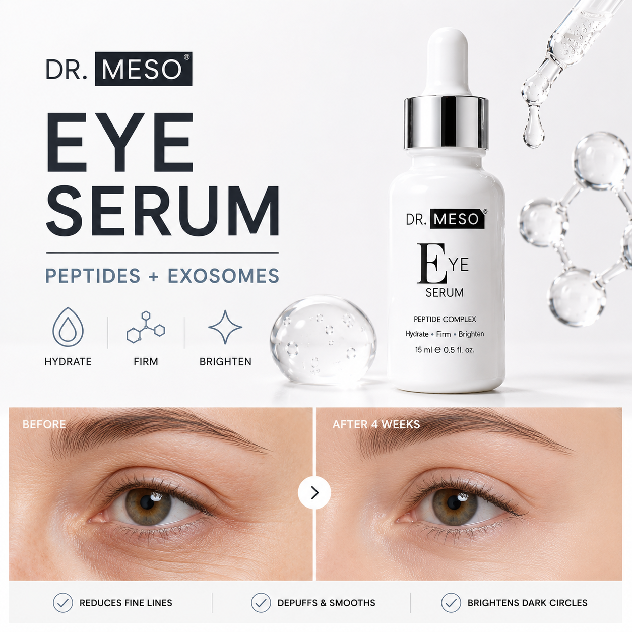 DR.MESO Eye Serum with Peptides and Exosomes before and after eye area results