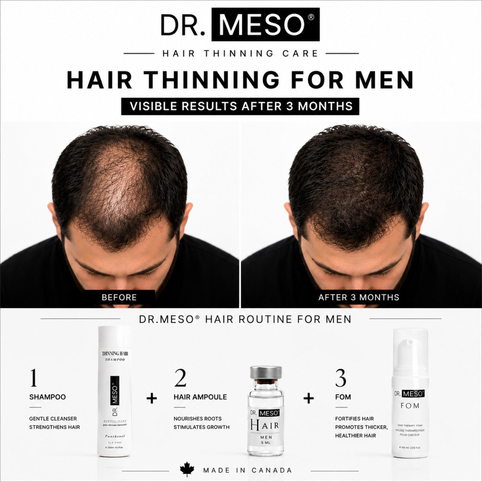 DR.MESO Thinning Hair Shampoo bottle — clean Canadian daily care
