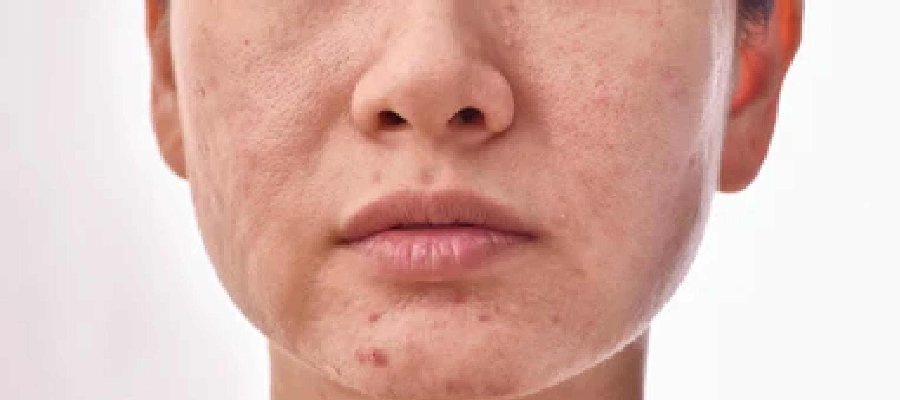 Close-up of a person's face with visible skin texture and freckles on a white background
