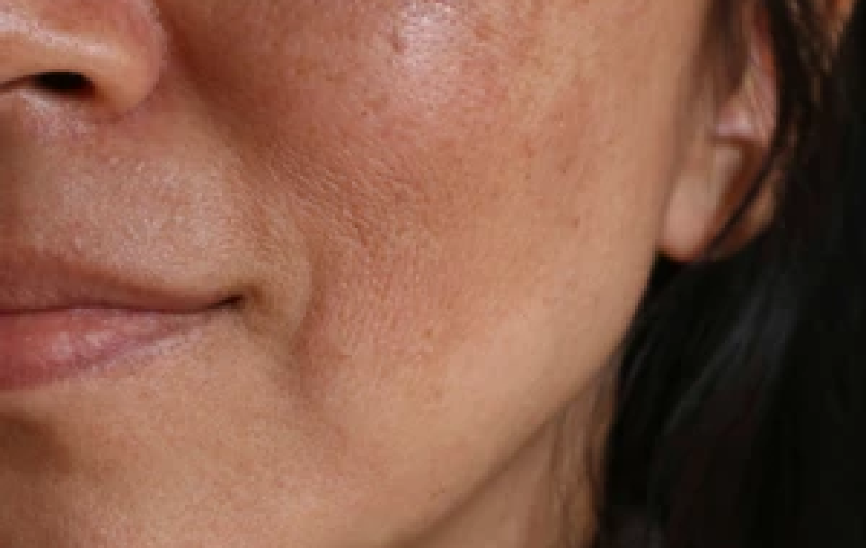 Close-up of a person's face with visible skin texture
